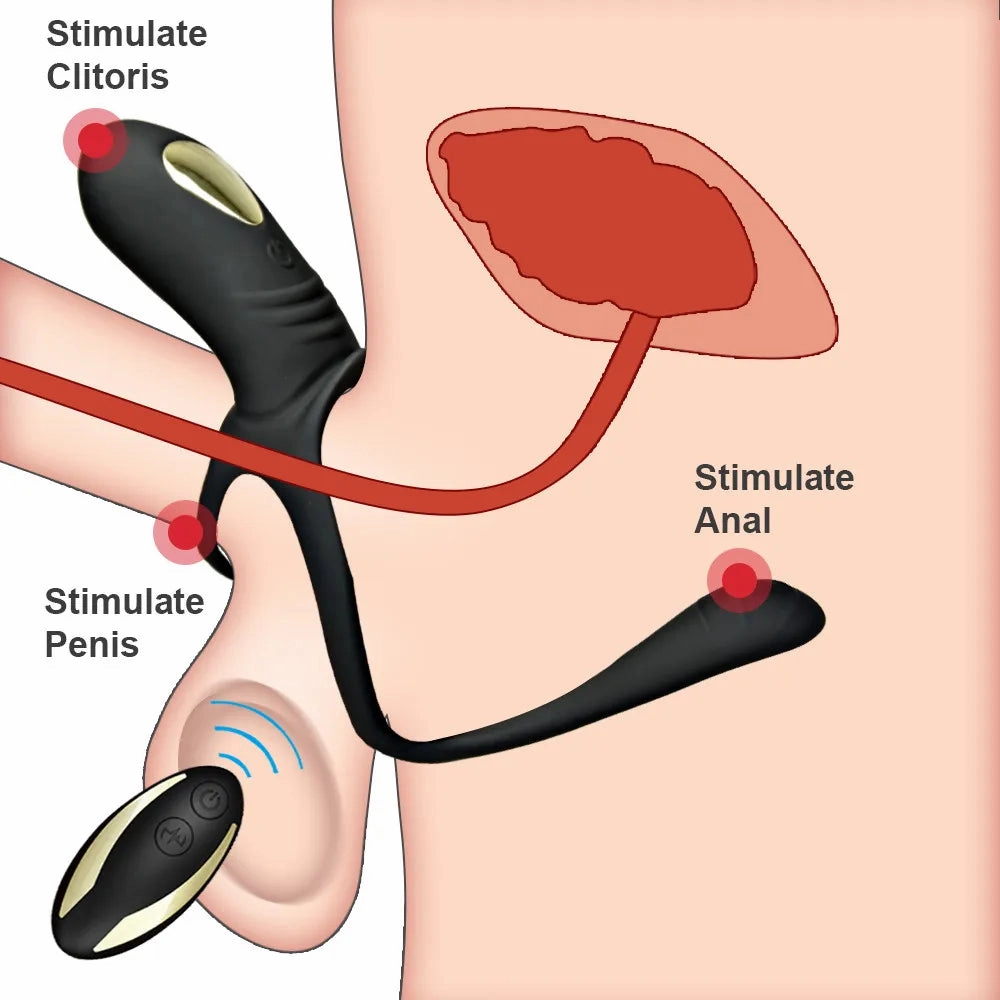 Dual-Function Penis Ring for Delayed Ejaculation and Intense Orgasms